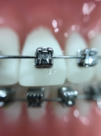 Consejos de higiene oral durante el confinamiento
